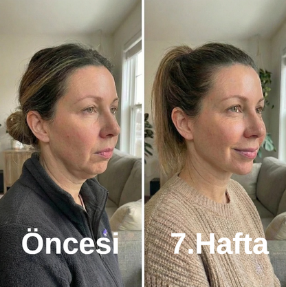 Kolajen Yüz Şekillendirici Maske