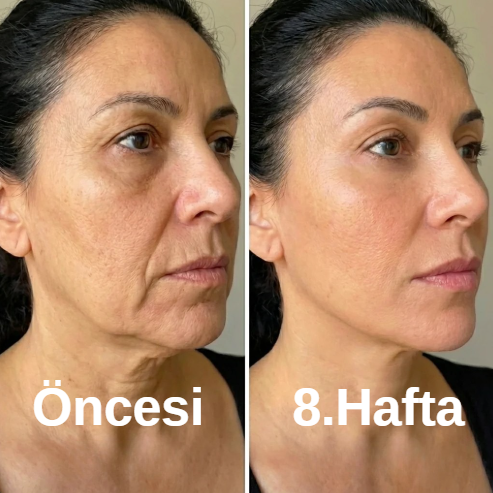 Kolajen Yüz Şekillendirici Maske